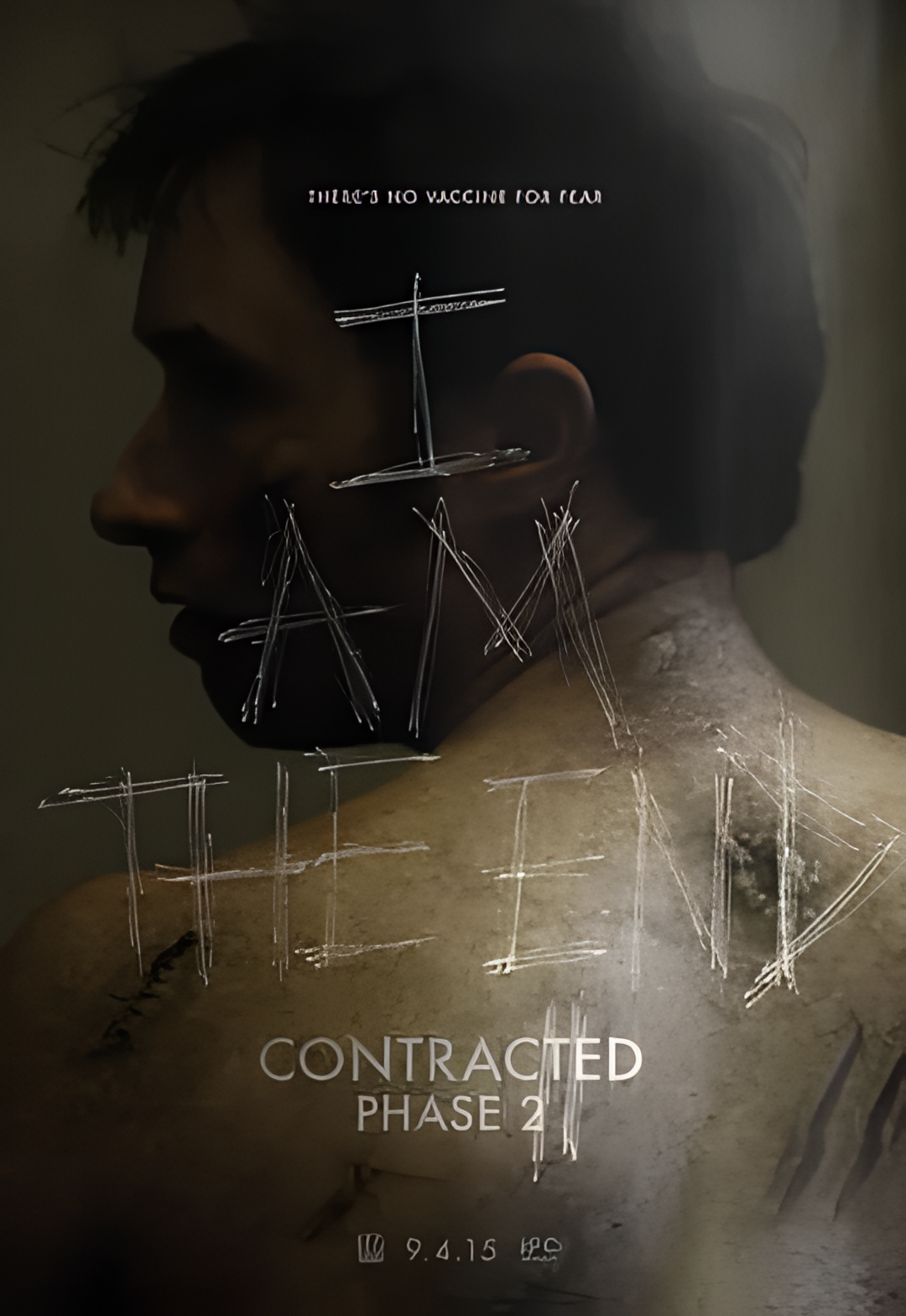 神秘感染：第二阶段